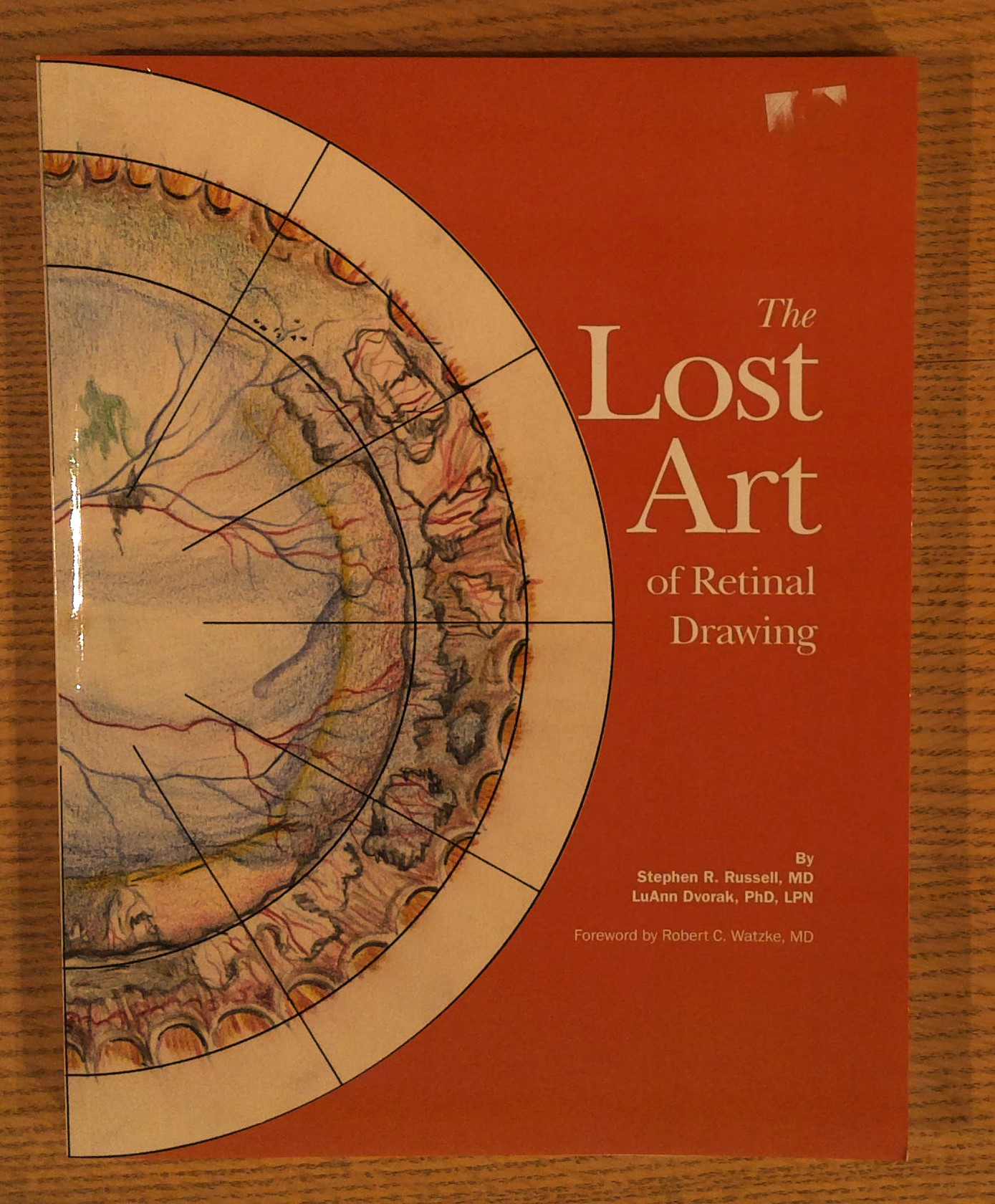The Lost Art of Retinal Drawing